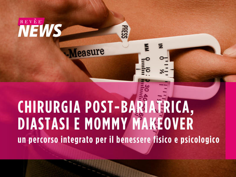 Chirurgia post-bariatrica, diastasi e mommy makeover