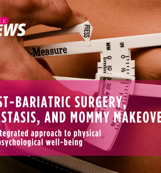 Post-Bariatric surgery, diastasis, and mommy makeover: an integrated approach to physical and psychological well-being