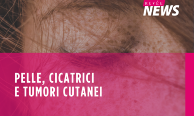 pelle, cicatrici e tumori cutanei