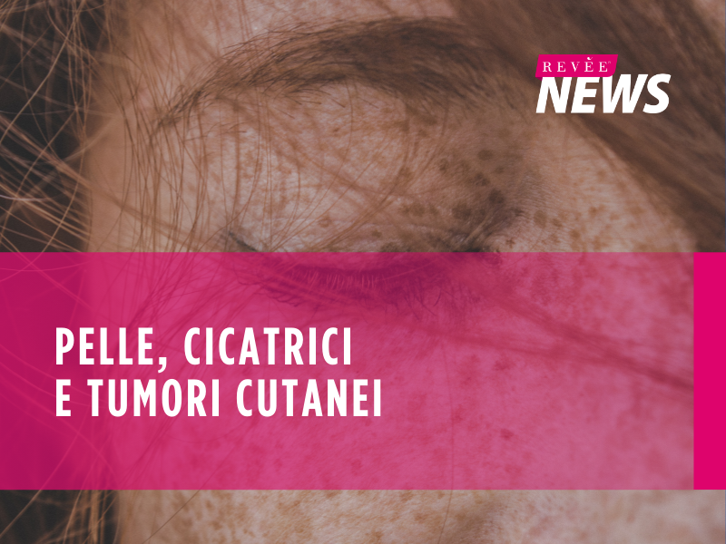 pelle, cicatrici e tumori cutanei